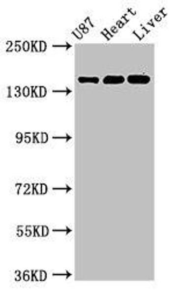 GRIN2A Antibody (PACO33412)