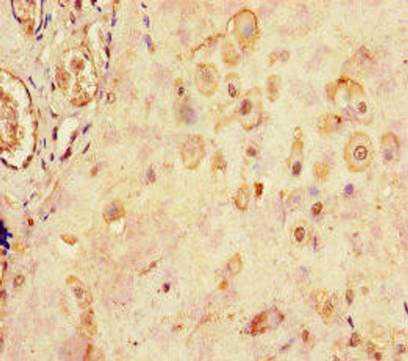 LHB Antibody (PACO33496)