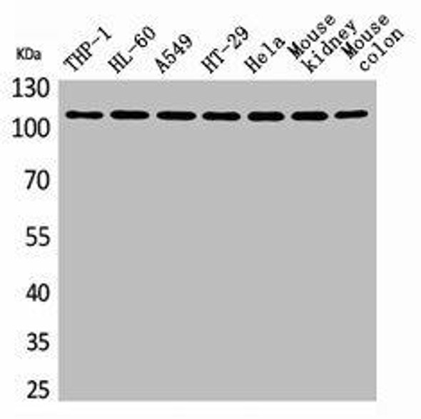 PLA2G4A Antibody (PACO01890)