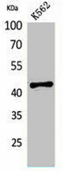 BCAT1 Antibody (PACO02119)