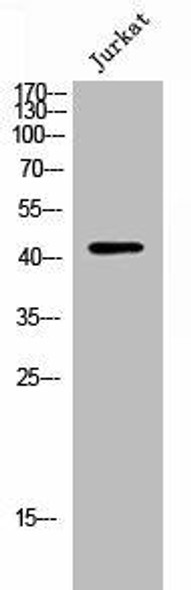 ATG4B Antibody (PACO02758)