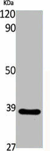 CYSLTR2 Antibody (PACO06405)