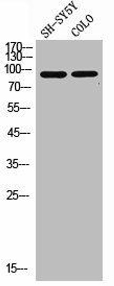 MDM2 Antibody (PACO06630)