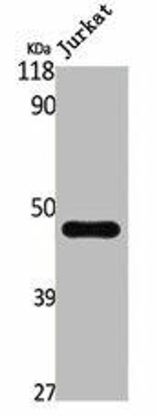 PTEN Antibody (PACO06782)