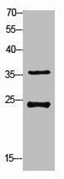 RPS4X Antibody (PACO06798)