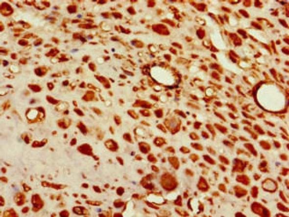 TBX6 Antibody (PACO49054)