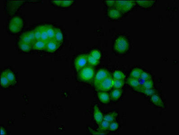 GNPDA2 Antibody (PACO49266)