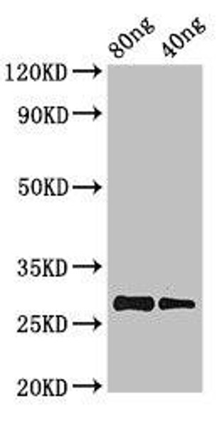 PRL Antibody (PACO49902)