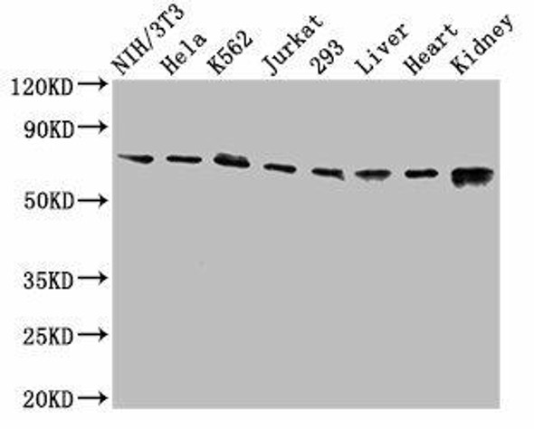 RIPK1 Antibody (PACO55122)