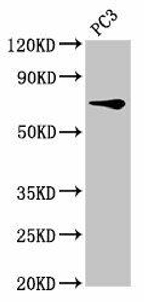 SCNN1B Antibody (PACO55770)