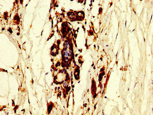 POLR3B Antibody (PACO56210)