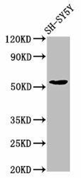 MZF1 Antibody (PACO56342)