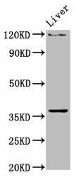 USF2 Antibody (PACO57148)