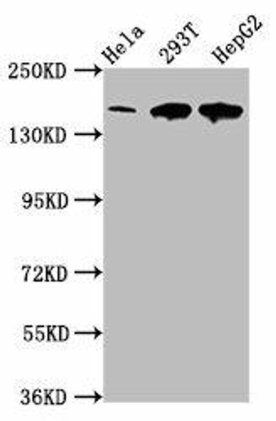 LRPPRC Antibody (PACO57844)