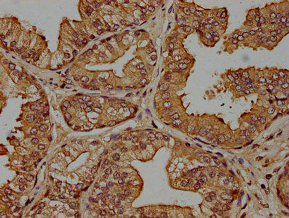 CRH Antibody (PACO61919)