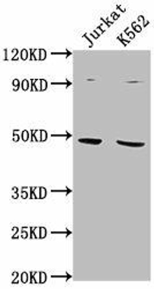 PSMD6 Antibody (PACO62043)