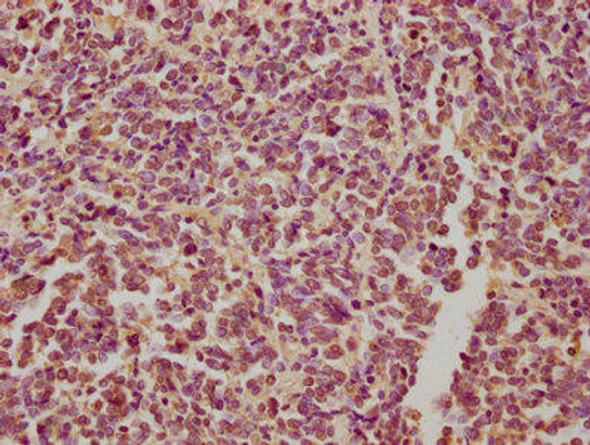 DAG1 Antibody (PACO63067)