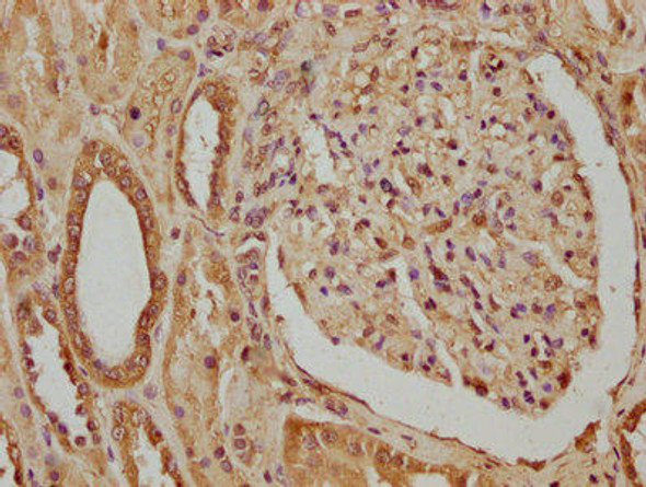 CTHRC1 Antibody (PACO63159)