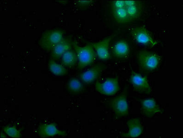 CSNK1G3 Antibody (PACO63919)