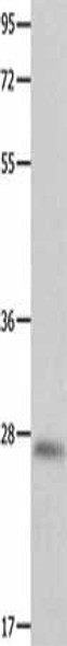 CDKN1B Antibody (PACO14231)