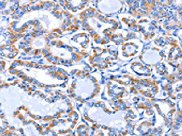 GJB3 Antibody (PACO14303)