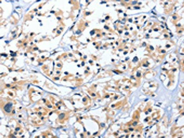EDN3 Antibody (PACO14401)
