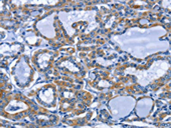 IFNG Antibody (PACO14552)