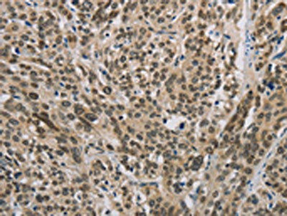 IRF9 Antibody (PACO14598)