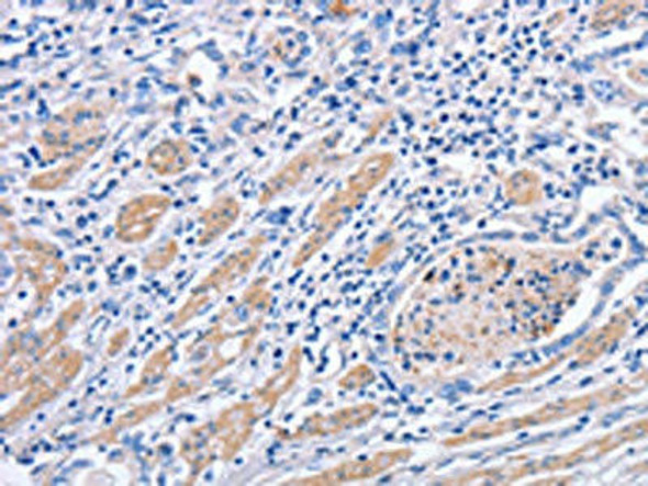 MATN3 Antibody (PACO14680)