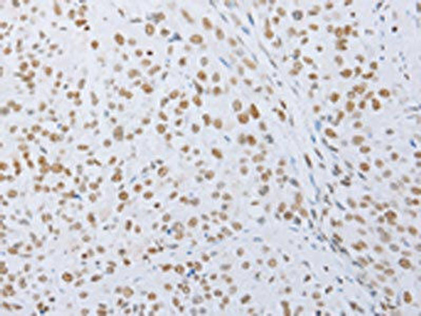 MCM2 Antibody (PACO14692)