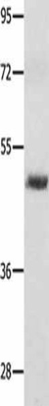 MITF Antibody (PACO14706)