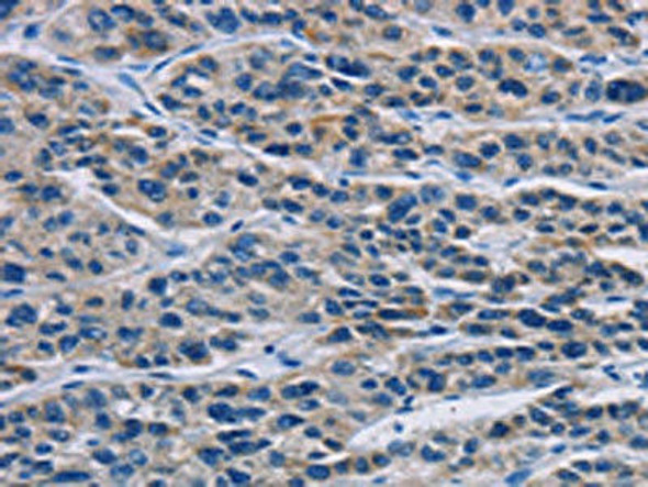 MSH5 Antibody (PACO14722)