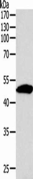 SIRT6 Antibody (PACO14985)