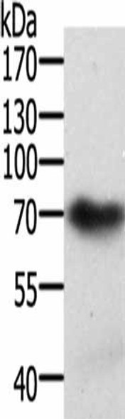 SPDL1 Antibody (PACO15039)