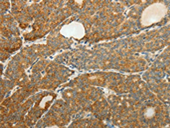 F3 Antibody (PACO15089)