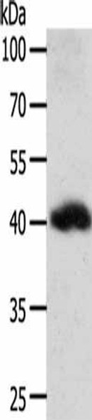 WNT9A Antibody (PACO15178)