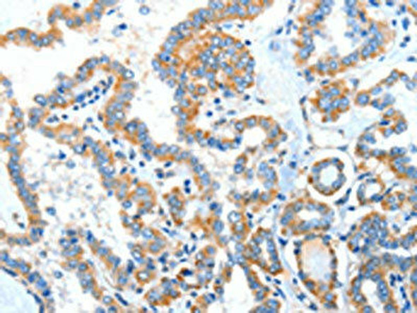 XBP1 Antibody (PACO15181)