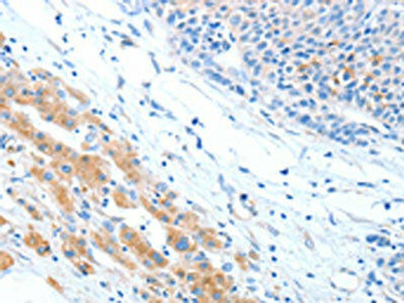 ADAM2 Antibody (PACO15308)