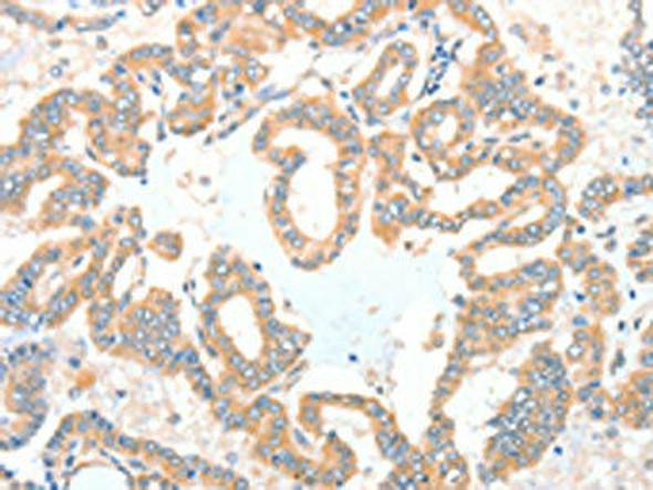 ADCK1 Antibody (PACO15320)