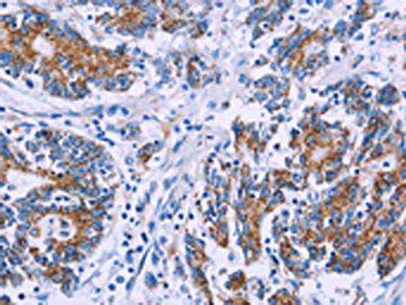 AGFG1 Antibody (PACO15347)