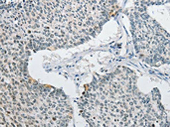 AP2M1 Antibody (PACO15454)