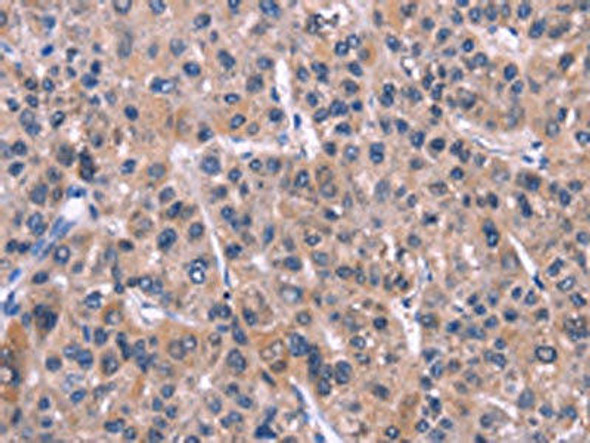 XPO1 Antibody (PACO15748)