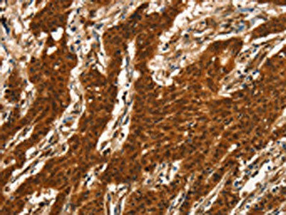CTNNBIP1 Antibody (PACO16085)