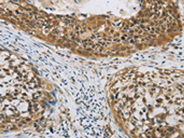 CYFIP2 Antibody (PACO16099)