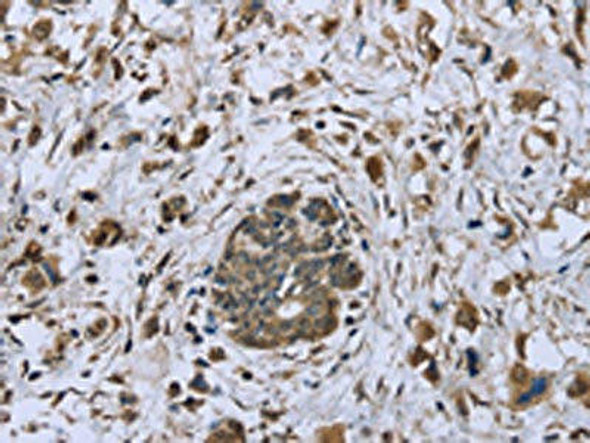 DCTN4 Antibody (PACO16157)