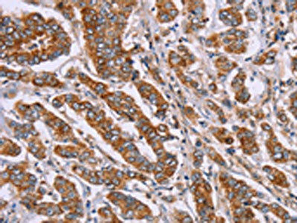 DCTN6 Antibody (PACO16161)