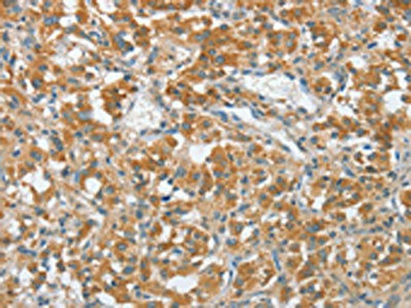 ENTPD5 Antibody (PACO16257)