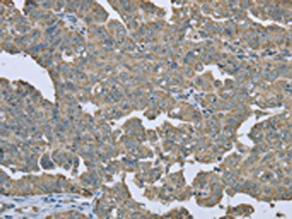 ESR2 Antibody (PACO16267)