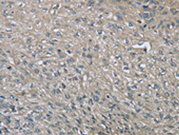 EZR Antibody (PACO16286)