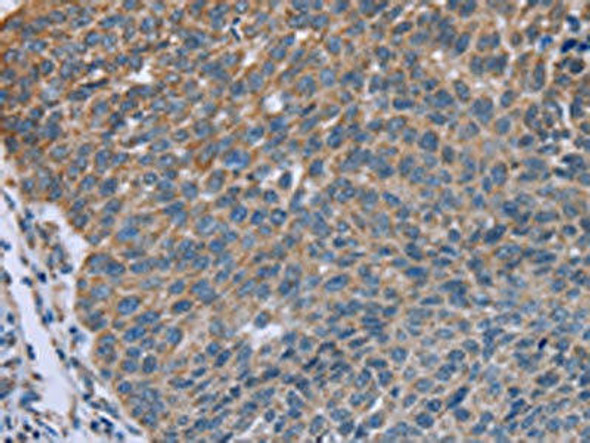 GNAI3 Antibody (PACO16388)